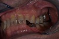 /album/riabilitazione-protesica-in-ceramica1/a1-jpg2/